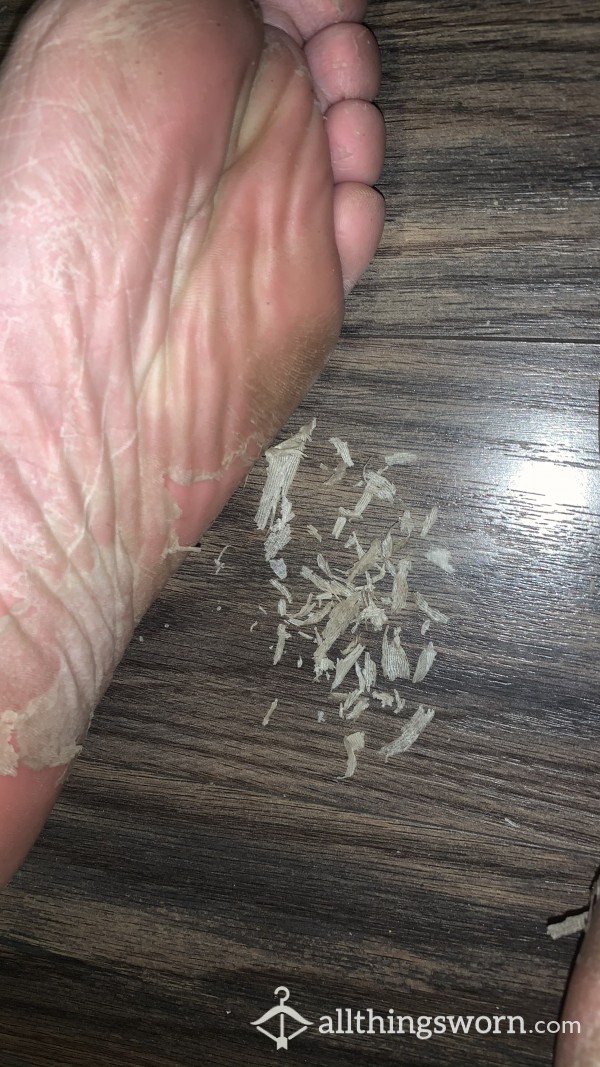 Crispy Crunchy Foot Skin