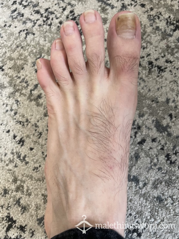 Feet Pics. Both Feet