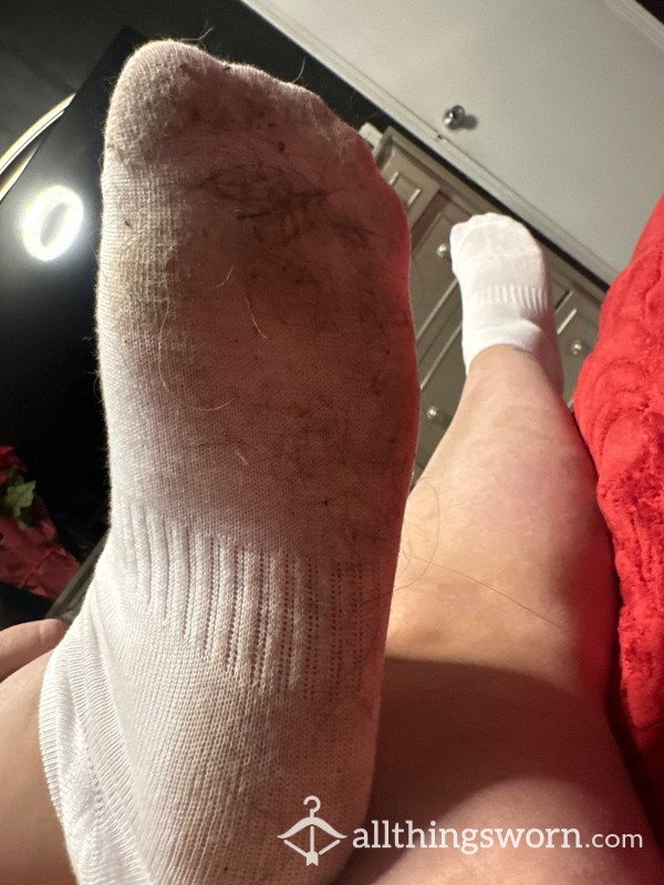 Hairy Socks