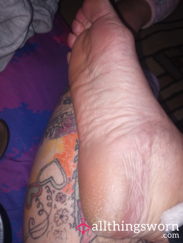 Tattooed Foot With Dry Heels